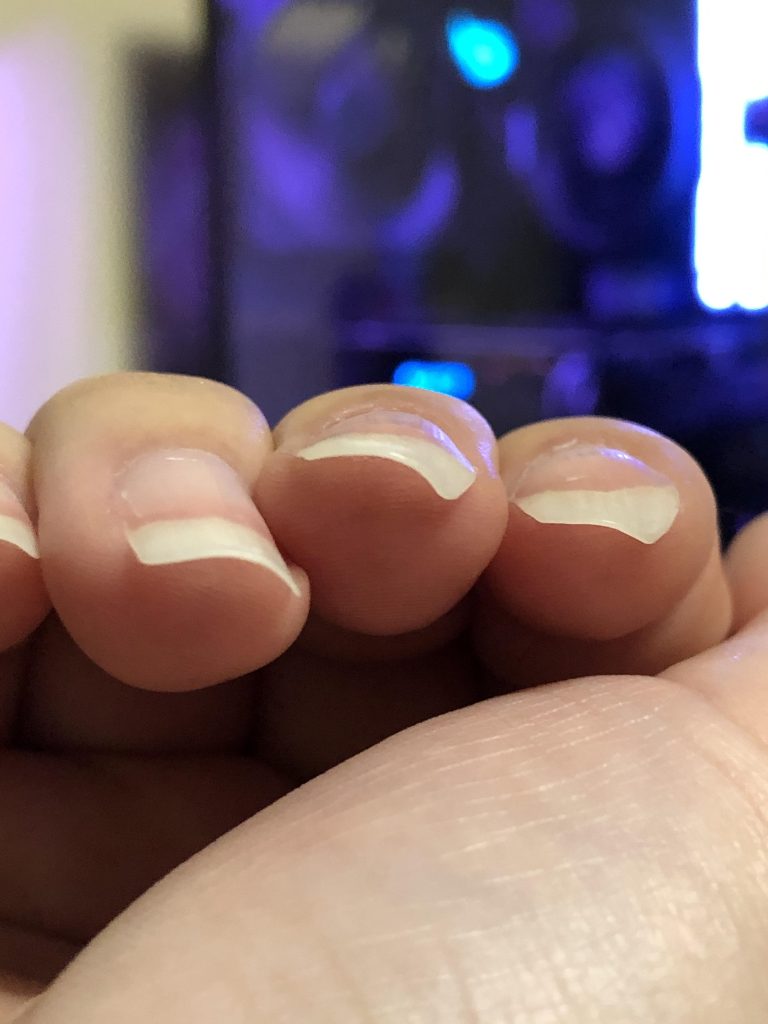 How to Stop Fingernails from Curling