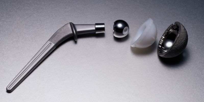 Why You Might Need Replacement Parts