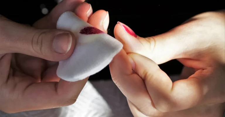 Cotton pad soaked in acetone wiping a bonded residue
