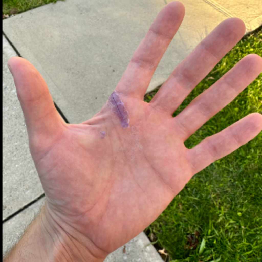 Medical-Grade Adhesives