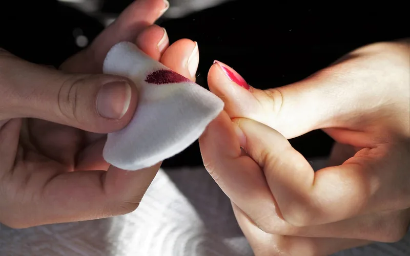 Acetone nail polish remover used to dissolve super glue